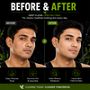 Anti Acne Face Wash