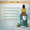 Anti Acne 2% Salicylic Acid & 5% Niacinamide Clearing Face Serum | Kokakoshi