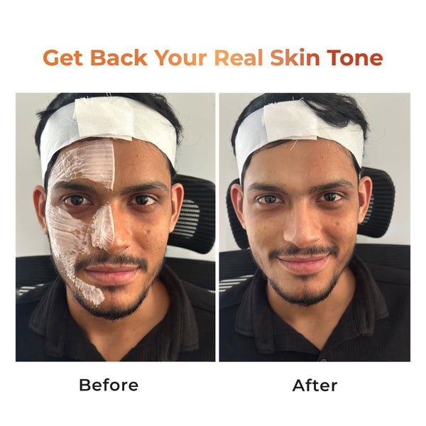 De-Tan Scrub — Tan Removal & Brightening Face & Body Scrub