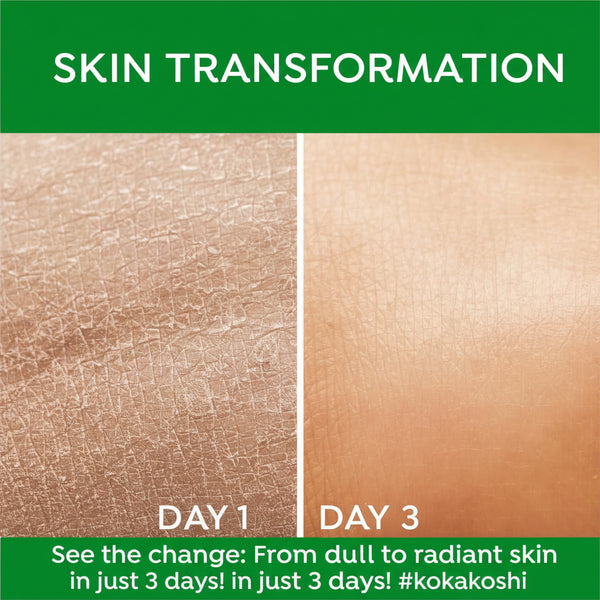 Aloe Vera Moisturizing Skin Cream – Cooling Relief & Long-Lasting Hydration | Kokakoshi